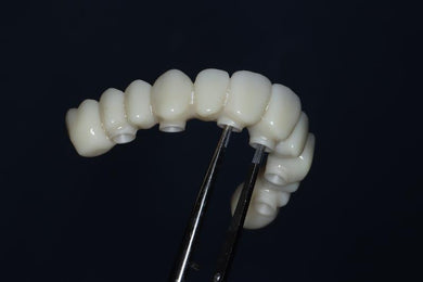 Dental model held by tweezers against a black background